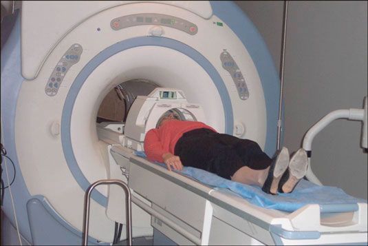 Photographie - Comment une IRM permet de confirmer un diagnostic de ms