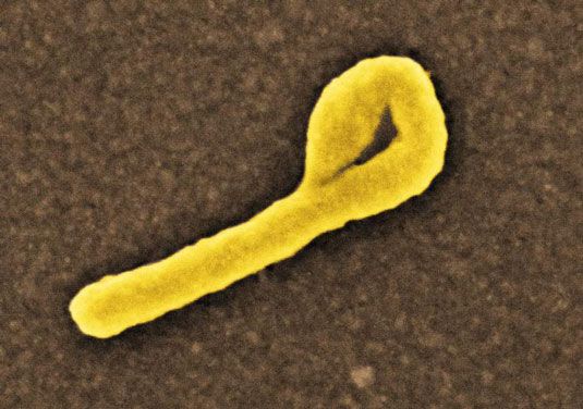 Comment fonctionne le virus Ebola