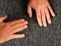 Comment réparer les tapis arraché ou déchiré