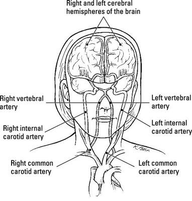 Accident vasculaire cérébral, autrement connu comme un & amp; # 147 & amp attaque cérébrale; ”-